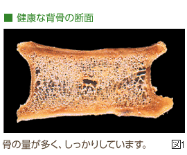 骨密度検査