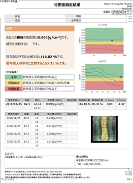 骨密度検査