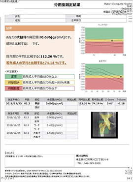 骨密度検査